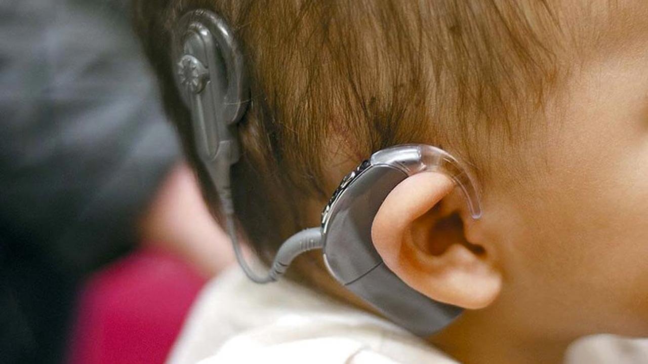 Get New Life Withcochlear Implant And Know The Cochlear Implant Price In India